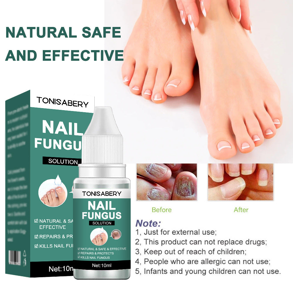Nail Fungus Repairing Nourishing